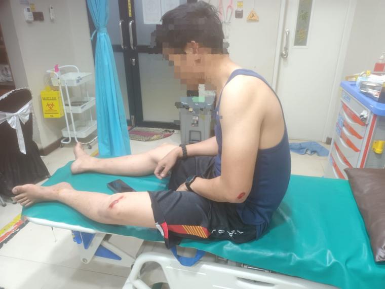 Kanit Reskrim Polsek Ciwandan Iptu Yofan Pratama Bachdar saat menjalani perawatan di RSKM Cilegon (Foto: Istimewa)